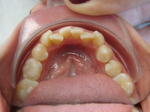 007 B-oclusal 030209 (2)