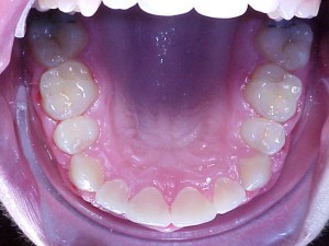 022 A-oclusal 210806